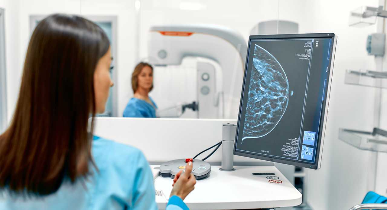 Mamografia: preparo e como é feita